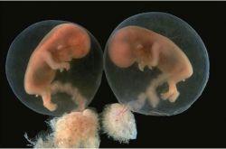 引发葡萄胎形成原因 4种高发人群需注意