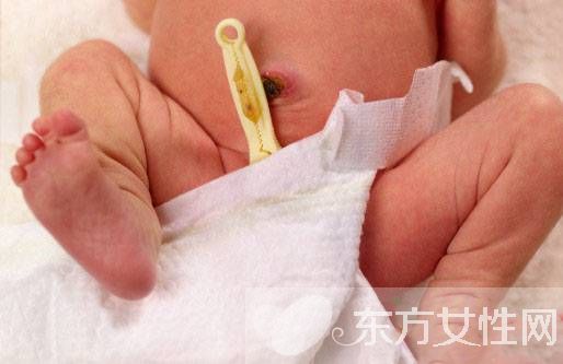 初生婴儿脐带护理方法 出现这些情况应及时就医