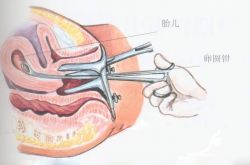 人工流产的最佳时间 人流后多久可以要小孩呢