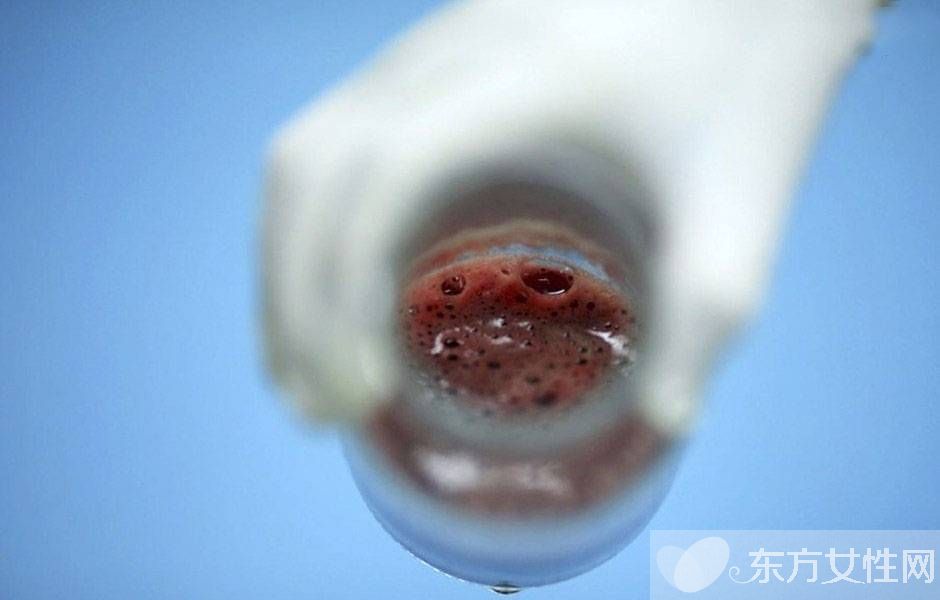 人流后多久来月经 人流后多久可以要孩子