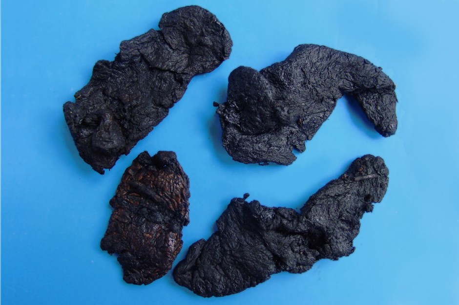 女性什么年龄闭经 6种闭经类型调理偏方