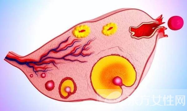 多囊卵巢综合症是怎么引起的 这么做可以有效预防哦