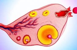 多囊卵巢综合症是怎么引起的 这么做可以有效预防哦