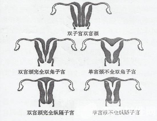 子宫发育不良的症状表现 子宫异常的危害居然这么大