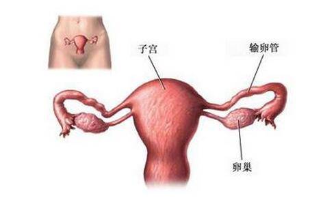 引起子宫畸形的原因 月经异常当心 双子宫