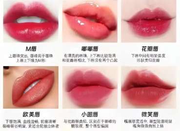 丰唇