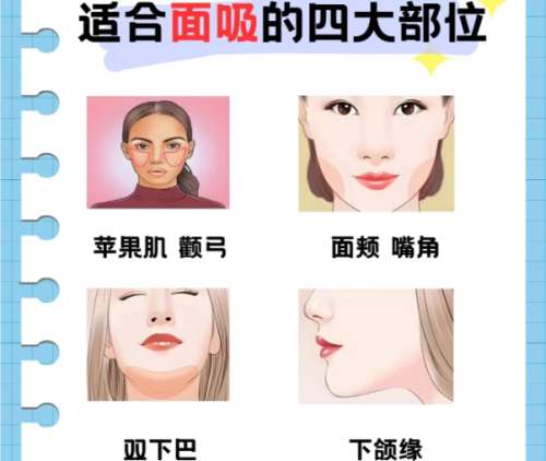 面吸 面吸