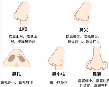 隆鼻