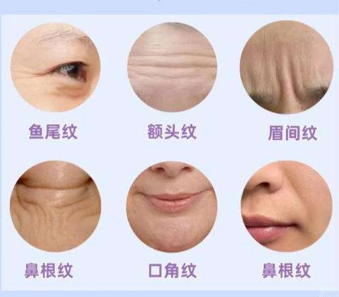 除皱2.jpg