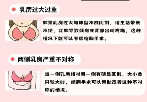 缩胸 缩胸