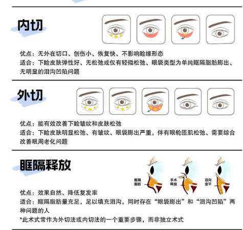 眼袋5.jpg