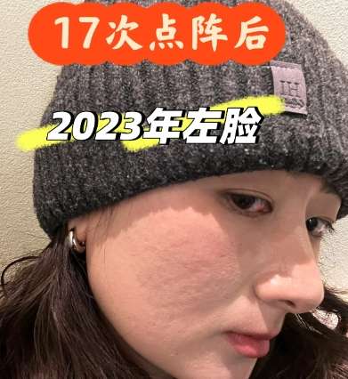 点阵激光h03.jpg