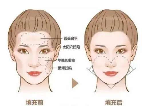QQ截图20231117111936.jpg