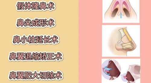鼻综合