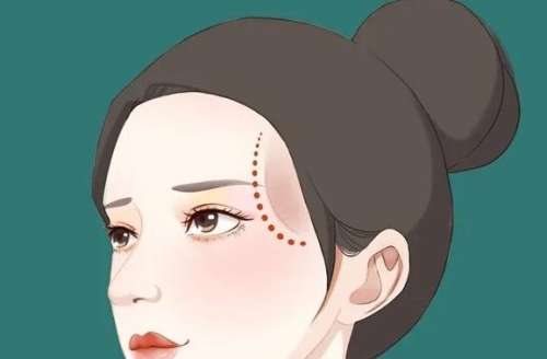 太阳穴填充03.jpg