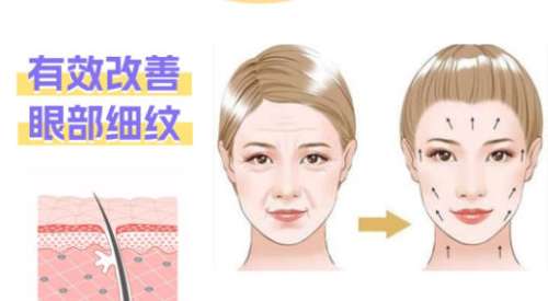除皱dmm1.jpg