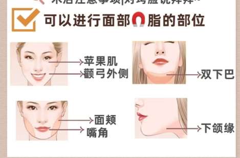 面吸