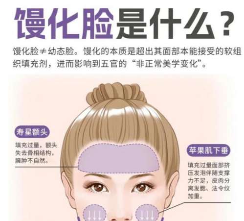 注射物取出 注射物取出