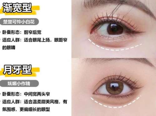 真皮卧蚕再造dm