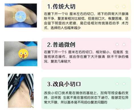 去腋臭