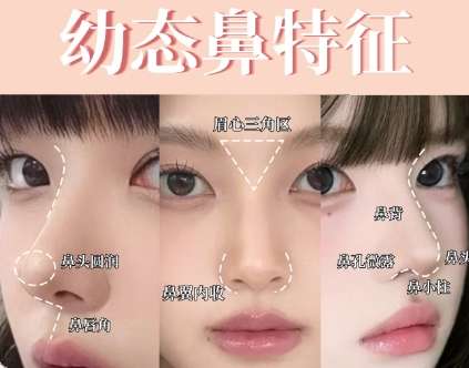 隆鼻hh02.jpg
