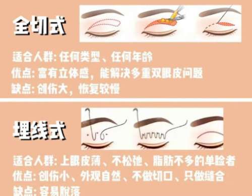 双眼皮
