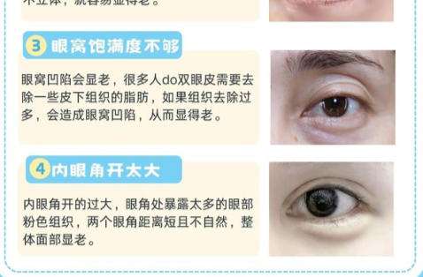 眼整形.jpg