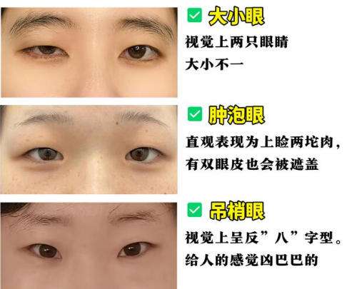 双眼皮8.jpg 双眼皮8.jpg