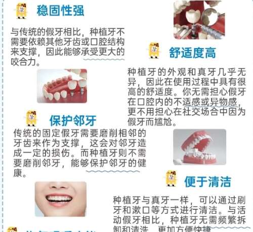 牙齿种植
