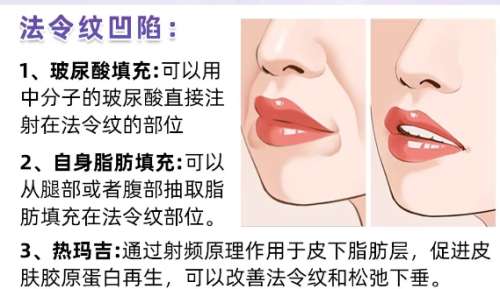 脂肪填充知识科普