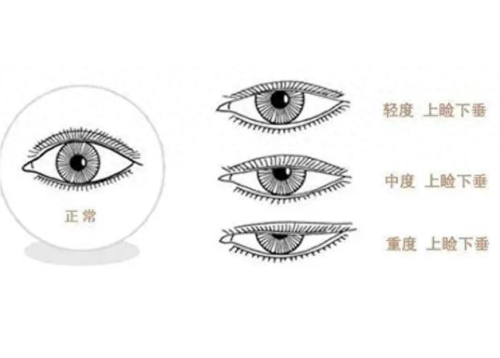 QQ20241014-111958.png