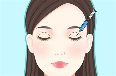 上海娜慕医疗美容医院修复医生谁技术好?双眼皮修复案例,更新价格