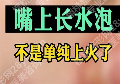 上火嘴唇起泡怎么办怎么快速消除?什么原因导致,整理多方面知识点