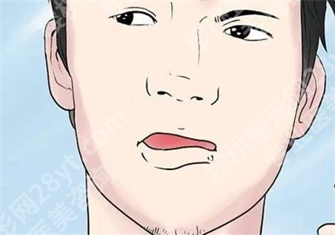 上火嘴唇起泡怎么办怎么快速消除?什么原因导致,整理多方面知识点