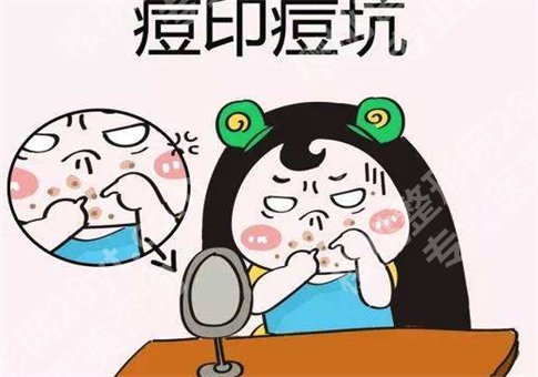 脸上有痘印怎么办?激光调节痘印效果怎么样?小方法及手术形式都已解答