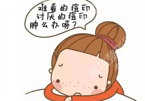 脸上有痘印怎么办?激光调节痘印效果怎么样?小方法及手术形式都已解答