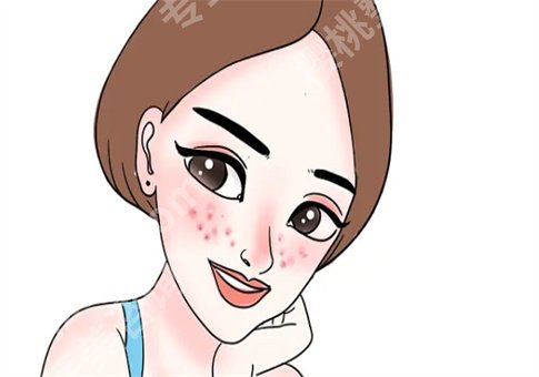 脸上有痘印怎么办?激光调节痘印效果怎么样?小方法及手术形式都已解答