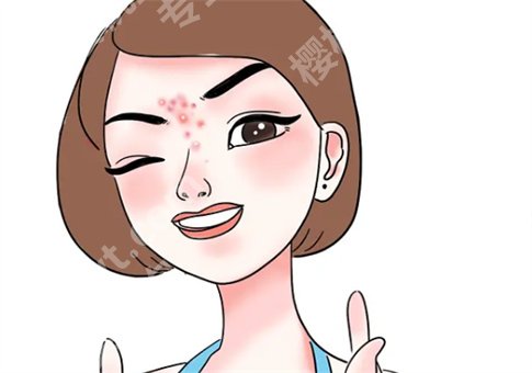 脸上有痘印怎么办?激光调节痘印效果怎么样?小方法及手术形式都已解答