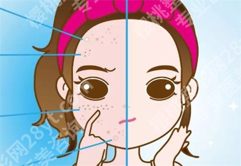 如何淡斑祛斑小妙招?分享解决斑点的方法,有斑点者的福音来了