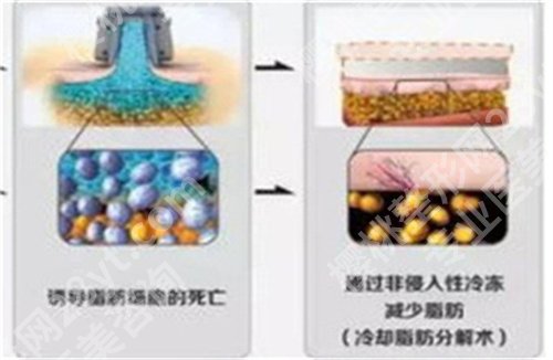 北京丽星翼美是三甲医院吗?热门项目介绍,价格更新