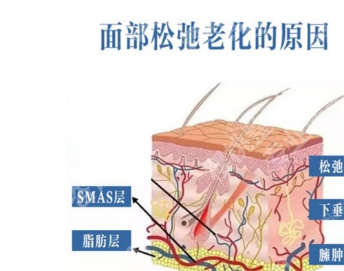 北京美莱做提升好的医生怎么样?技术好吗?看解说
