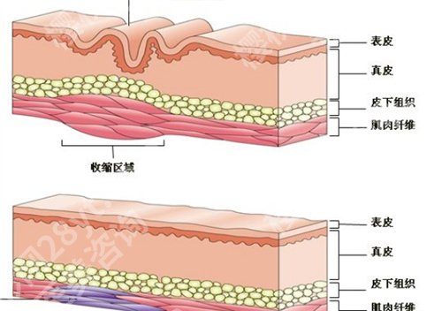 深圳协和医院激光多少钱？2024年价格表查看，医院基本信息