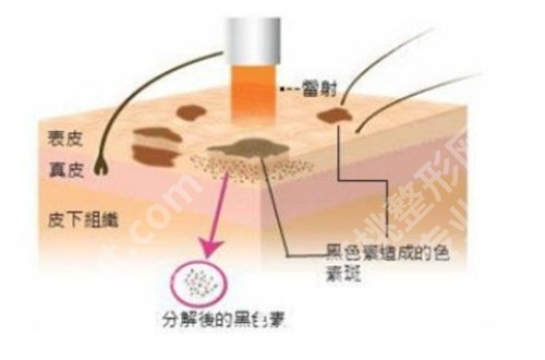 中山大学附属第三医院祛斑多少钱?医院详情,口碑点评