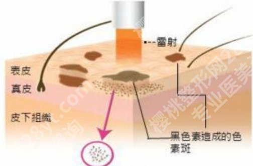 广东省皮肤病医院激光美肤中心收费如何？医院详情曝光