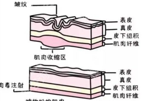 广东省皮肤病医院激光美肤中心收费如何？医院详情曝光