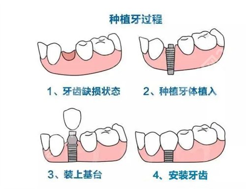 广州人民医院口腔科怎样?基本信息,一站式掌握