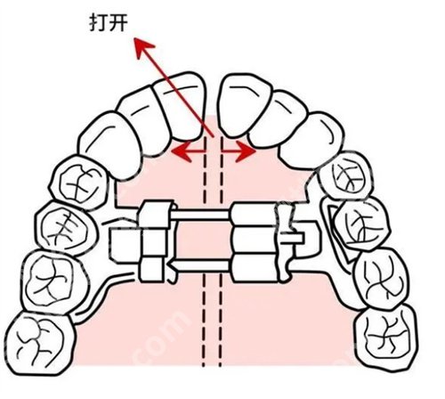 广州人民医院口腔科怎样?基本信息,一站式掌握