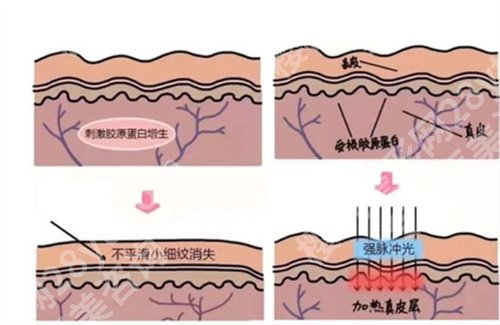 广东省第二人民医院激光整容科怎么样?看近期顾客点评