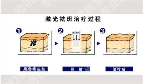 上海九院祛斑挂什么科?看医院科室介绍