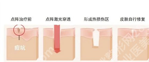 上海九院祛斑挂什么科?看医院科室介绍